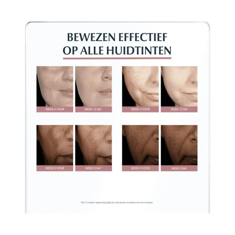 Eucerin Anti-Pigment Spot Corrector 5 ML