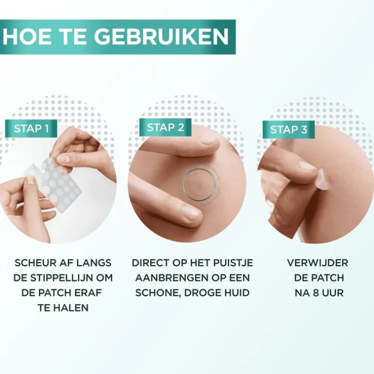Garnier Pure Active Pimple Patch 22 stuks
