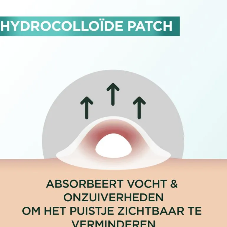 Garnier Pure Active Pimple Patch 22 stuks