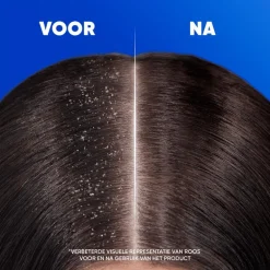 Head & Shoulders Classic Anti-roos Shampoo 300 ML