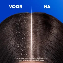 Head & Shoulders Classic Anti-roos Shampoo 95 ML