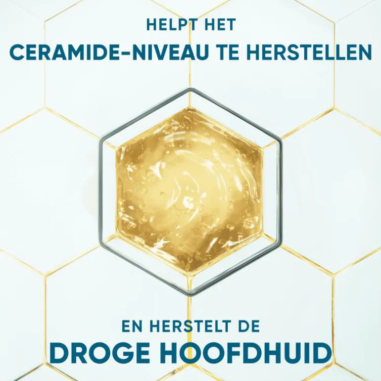 Head & Shoulders Derma X Pro Kalmeert Anti-Roos Shampoo 250 ML