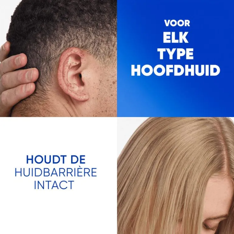 Head & Shoulders Jeukende Hoofdhuid Anti-Roos Shampoo 300 ML