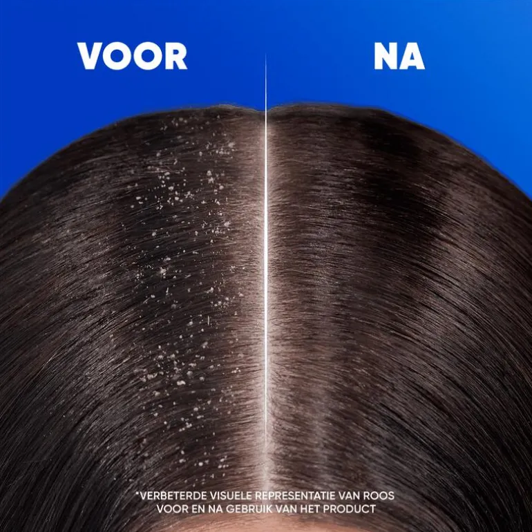 Head & Shoulders Menthol Fresh 2in1 Anti-Roos Shampoo & Conditioner 300 ML