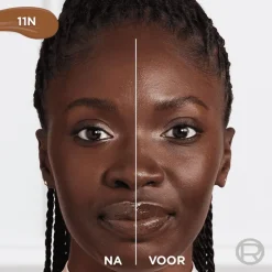 L'Oréal Paris True Match Radiant Serum Concealer 11N 11ML