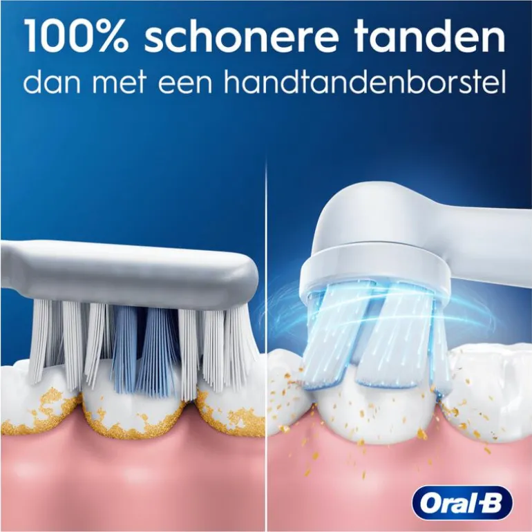 Oral-B iO 2 Roze Elektrische tandenborstel